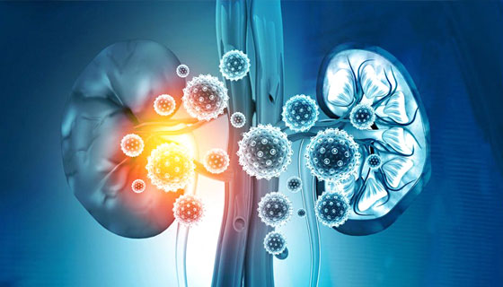 kidney stone treatment